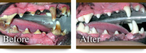 Professional dental cleaning before and after.