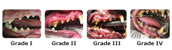 The 4 Stages of Dental Disease